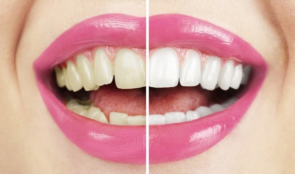 What Early Signs of Oral Cancer Should You Never Ignore Crewe?