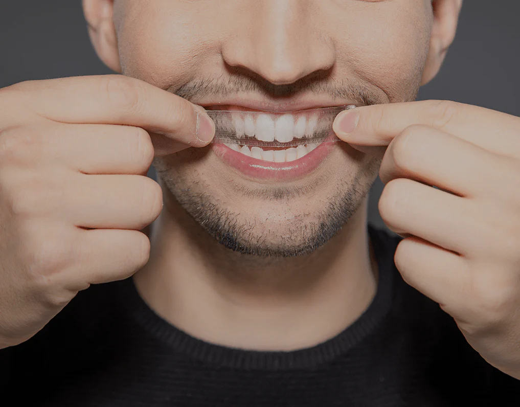 Can You Whiten Natural Teeth Without Harsh Chemicals Crewe?