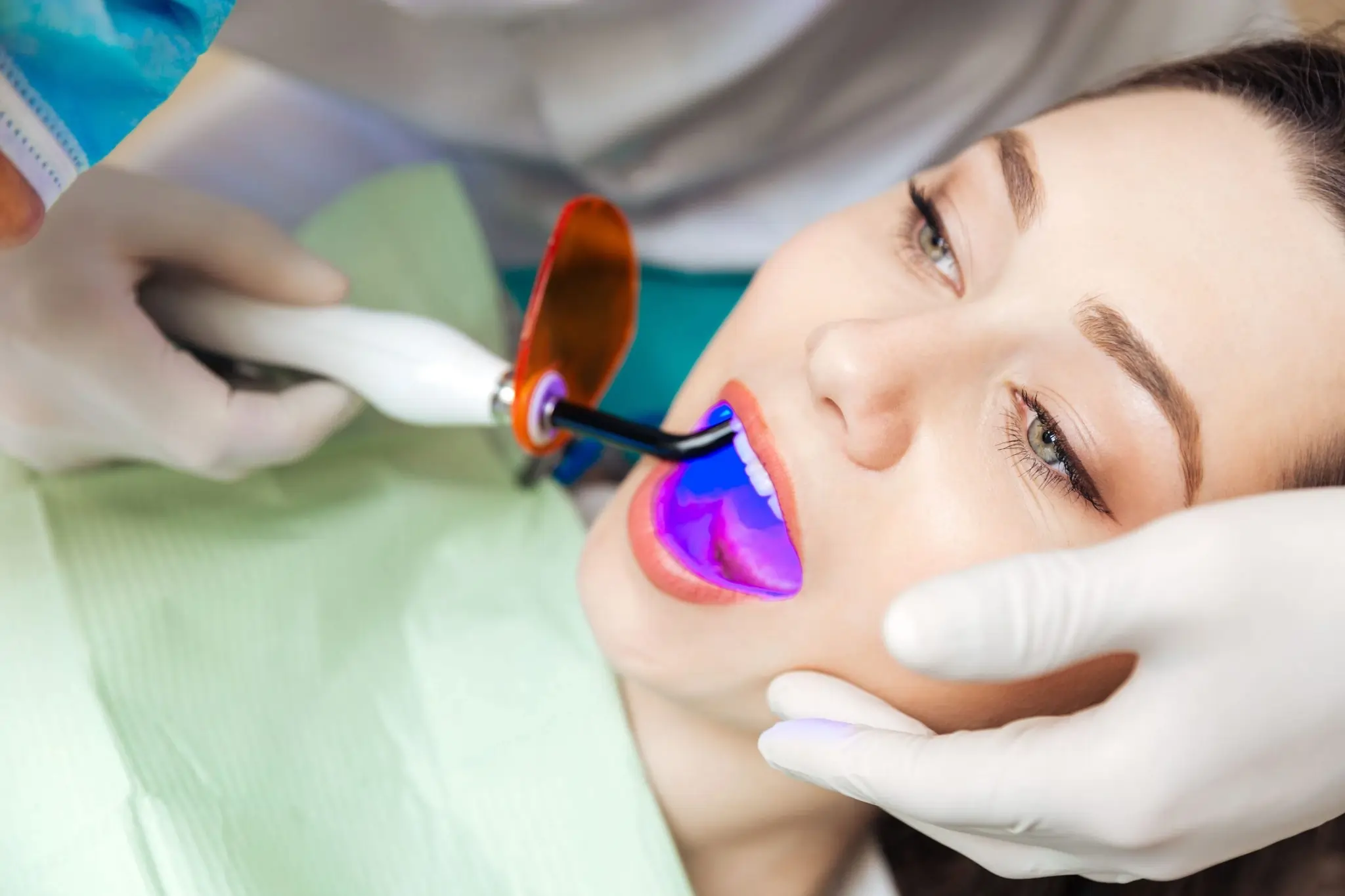 Common Risks of Whitening Without Expert Dental Guidance Crewe