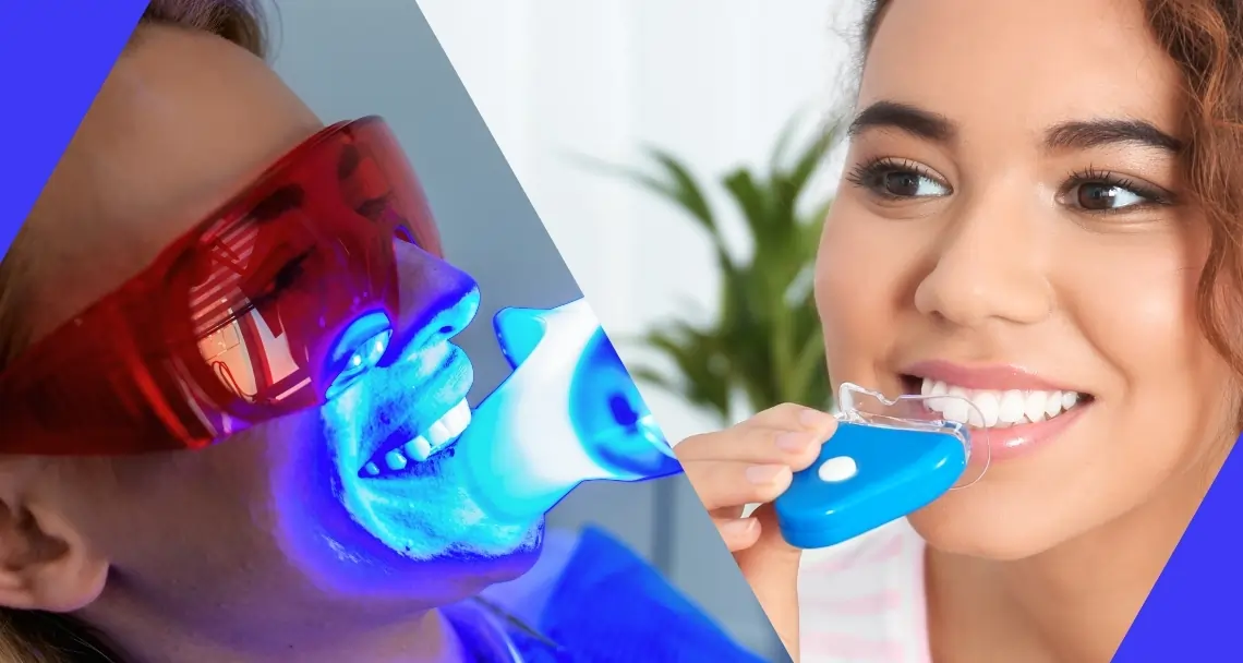 Expert Tips for Safe and Effective Whitening Crewe