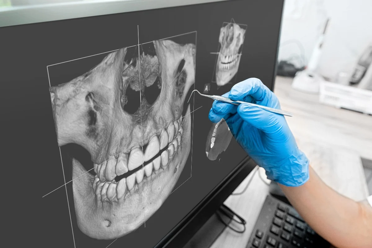 How Is AI Transforming Dental Treatment Planning Crewe?