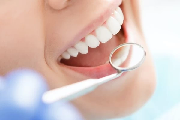 Can Your Smile Really Affect Your Confidence Crewe?