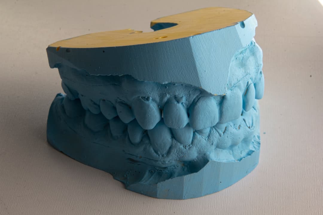 How Do Dental Implants Improve Jawbone Health and Oral Function Crewe?