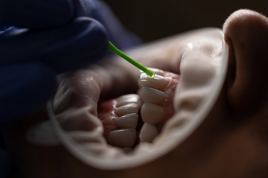 How Saliva Protects Your Teeth and Gums Crewe
