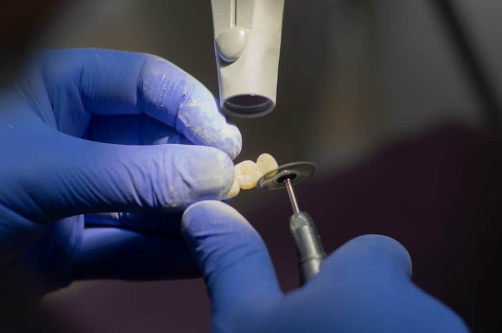 Customised Dental Solutions: Crowns, Aligners, and Implants Crewe