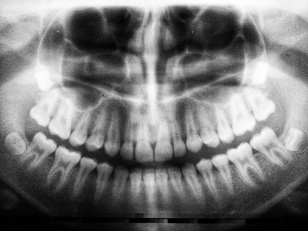 The Future of 3D Printing in Oral Healthcare Crewe